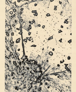 Pneumotaxic Burst